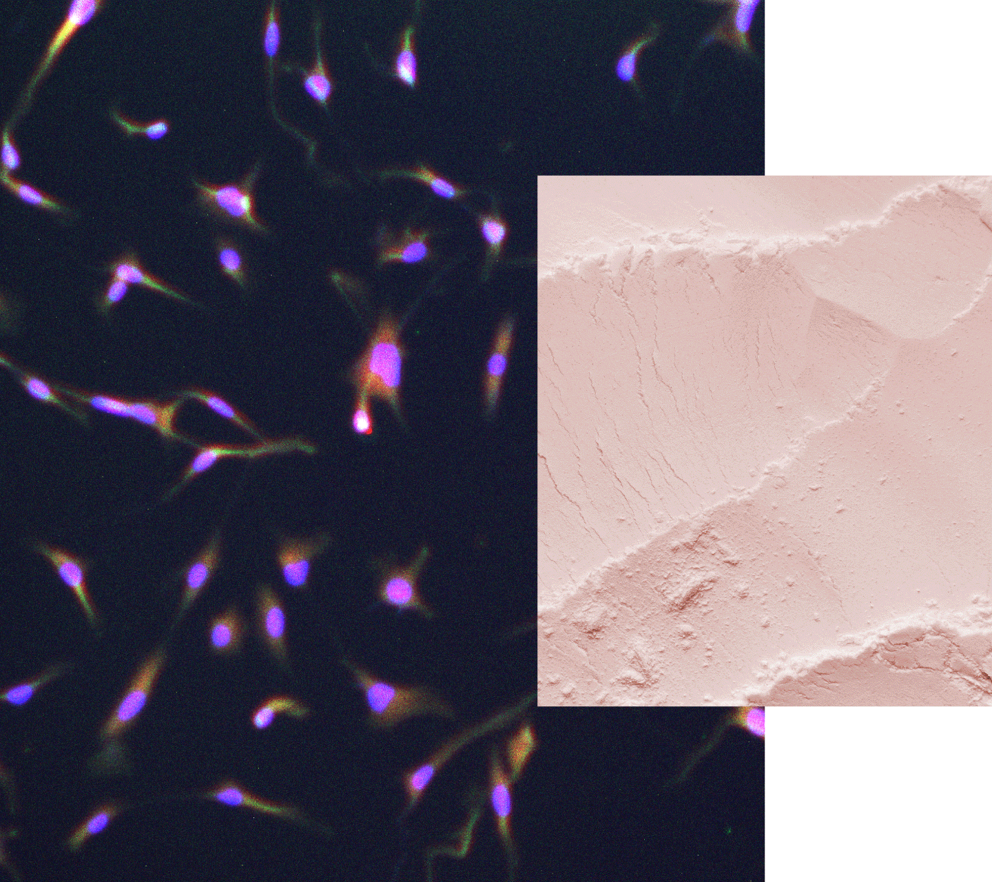 Human cells shown with lactoferrin powder